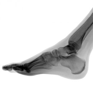 Foot_x-rays-300x300